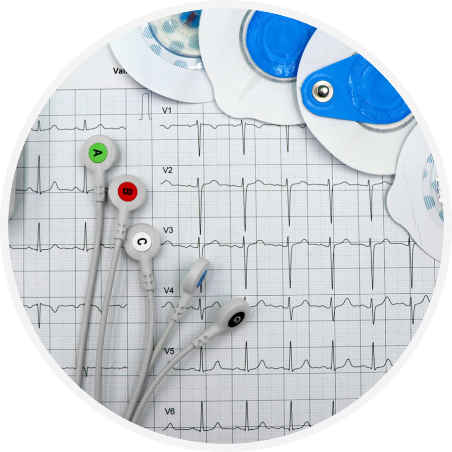 Electrocardiograma